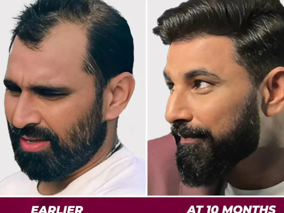 Jamalgota Ayurvedic Hair Growth Powder Buy 1 Get 1 Free🌿